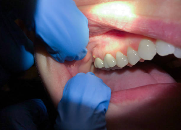Best Walk-In Emergency Dentist in Wyoming, OH